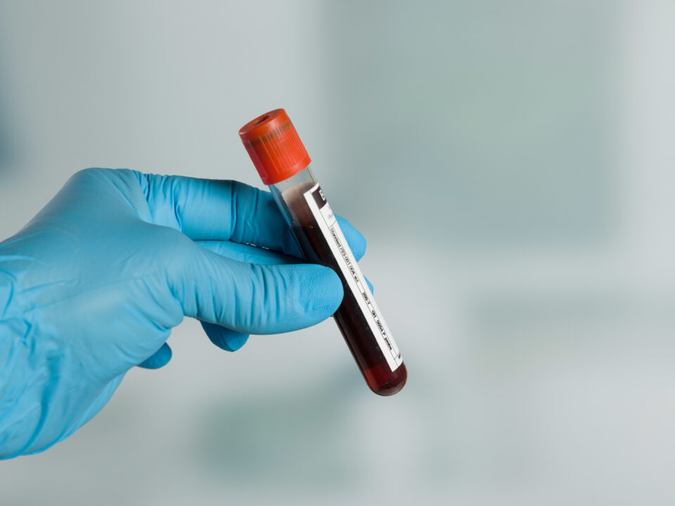 Liver Function Testing